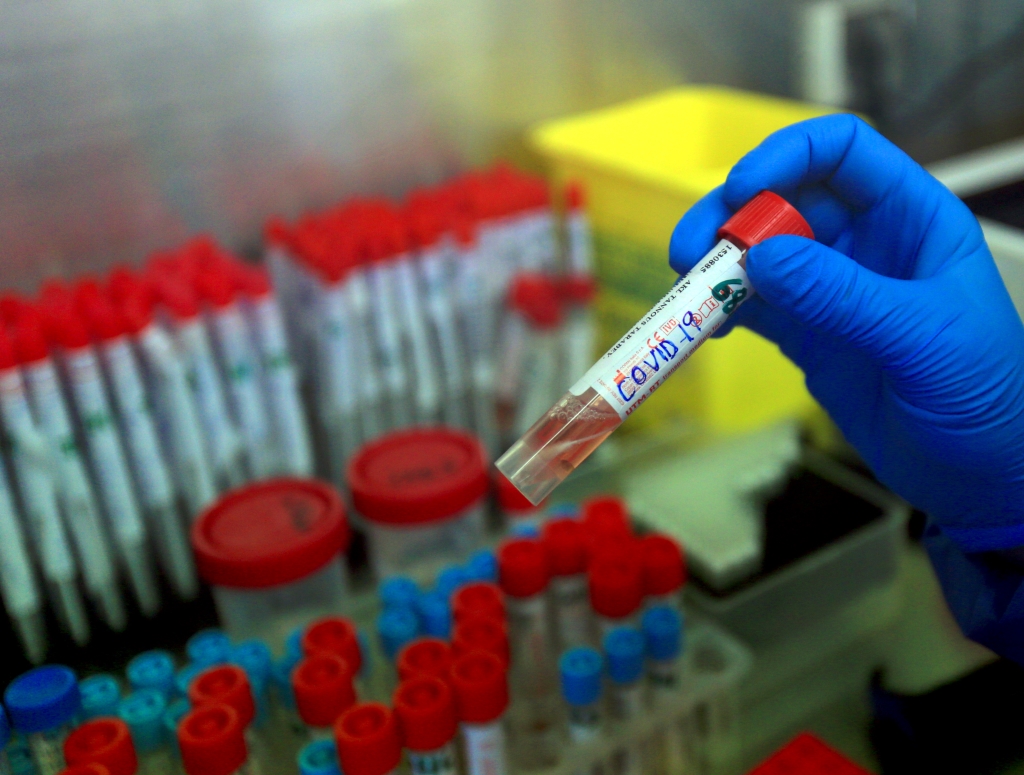 ارتفاع بعدد الوفيات.. العراق يسجل نحو 8 الاف اصابة بكورونا