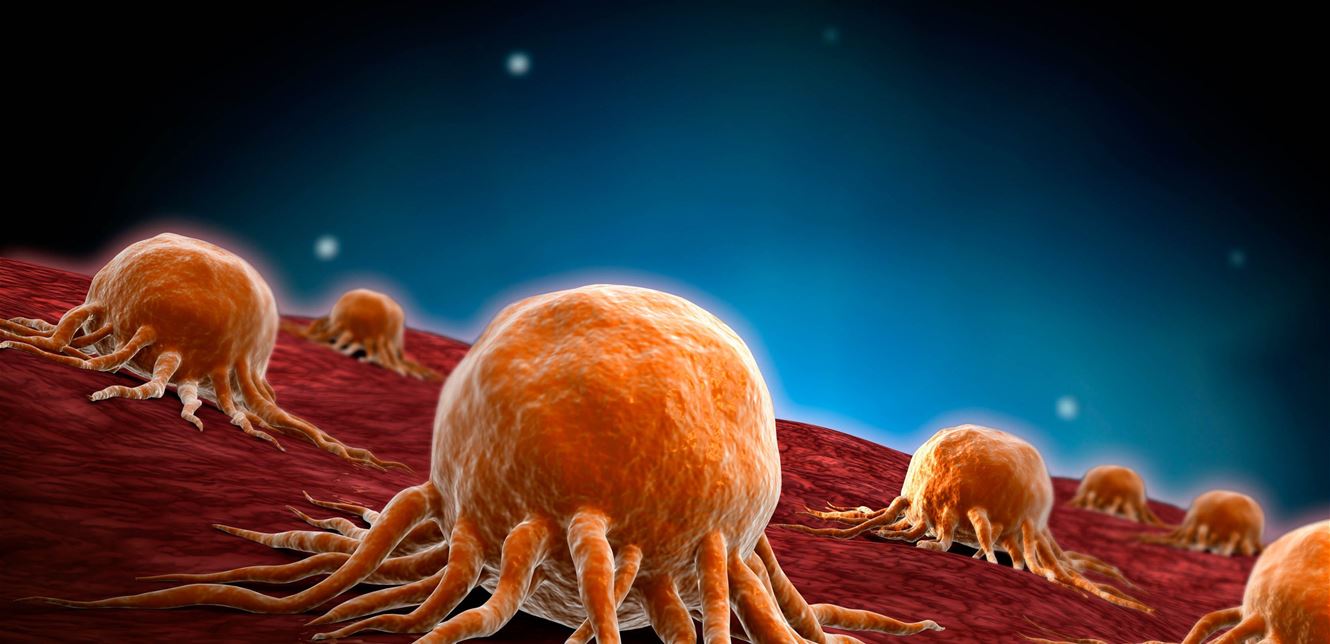 دراسة تفتح باب الأمل.. اكتشاف السرطان قبل وقت طويل من تشخيصه