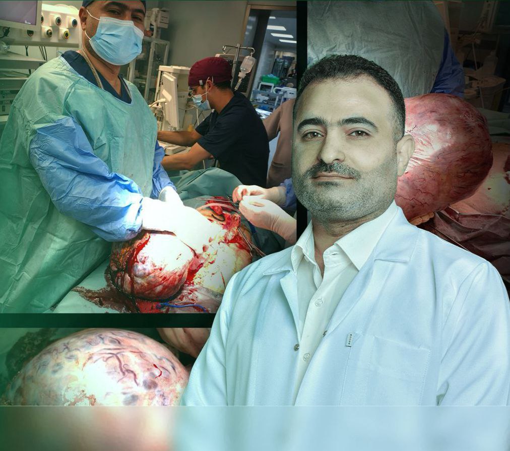 في مستشفى السفير.بكربلاء .. رفع ورم يزن (٨) كيلوغرامات من رحم سيدة عراقية