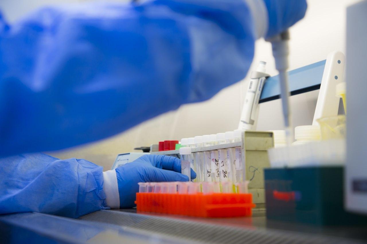 العراق يسجل اعلى حصيلة اصابات يومية بفيروس كورونا