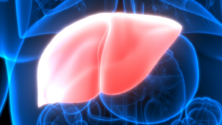 علامات مميزة قد تدل على الإصابة بمرض الكبد الدهني