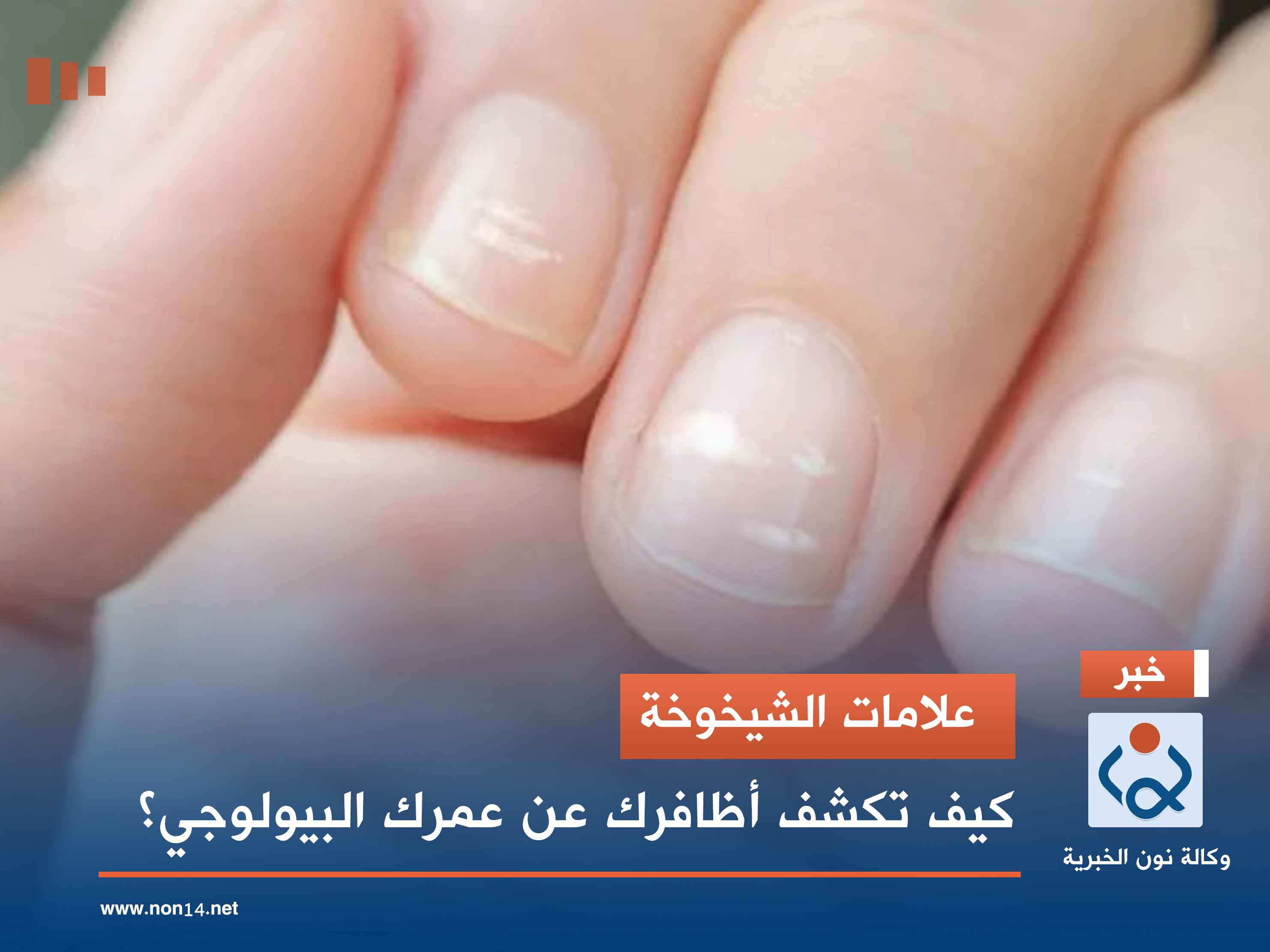 علامات الشيخوخة.. كيف تكشف أظافرك عن عمرك البيولوجي؟