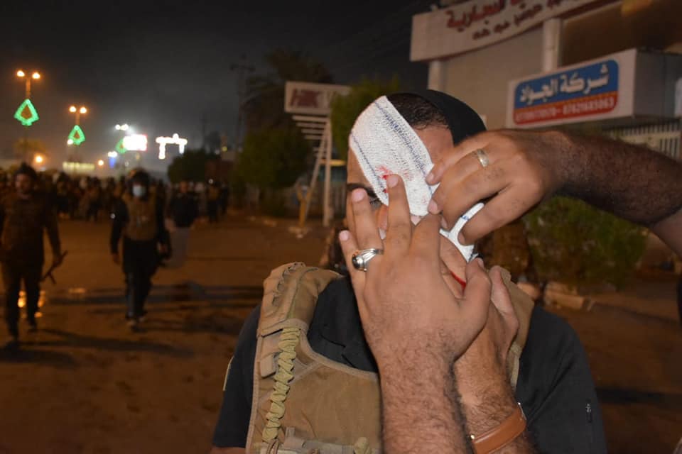 بالصور:شرطة كربلاء تعلن فقع عين احد منتسبيها واعتداءات على الاملاك العامة والخاصة من قبل متظاهرين غير سلميين