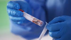 كورونا يتضاءل بشكل كبير بالعراق...جدول الاصابات