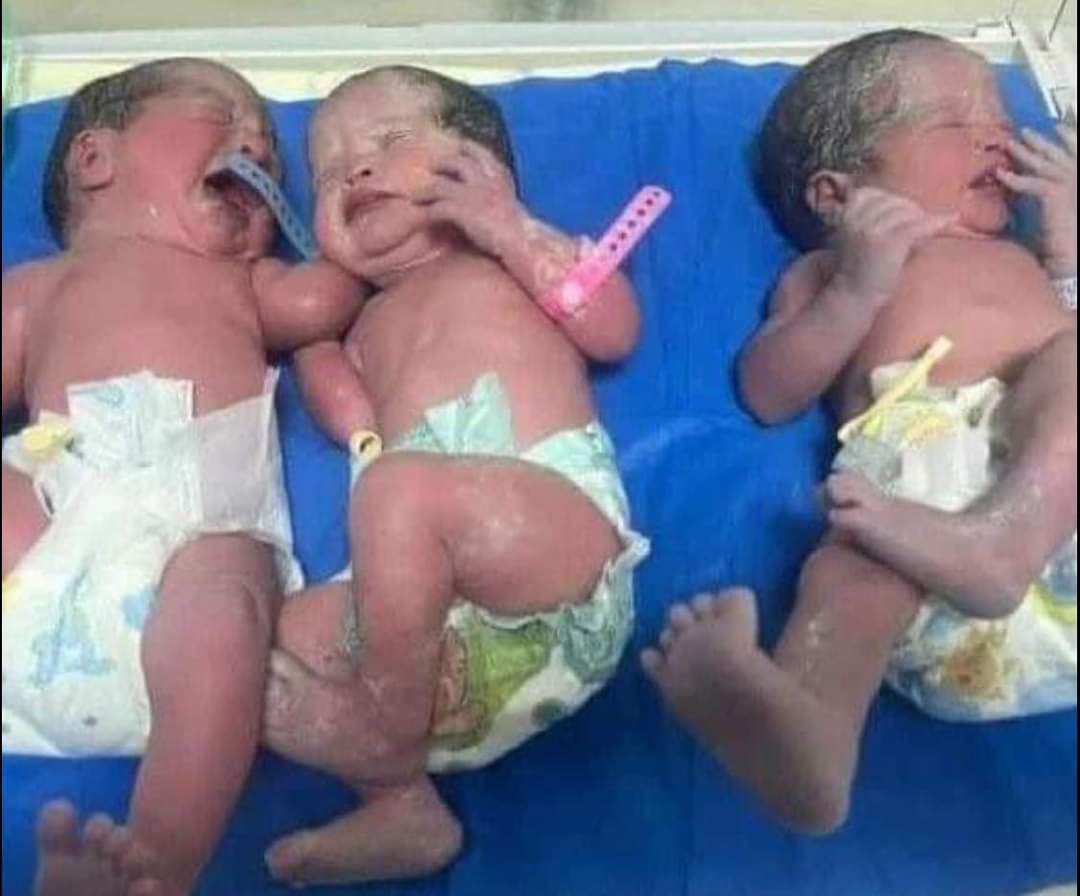 ولادة ثلاث توائم في بغداد لسيدة عشرينية