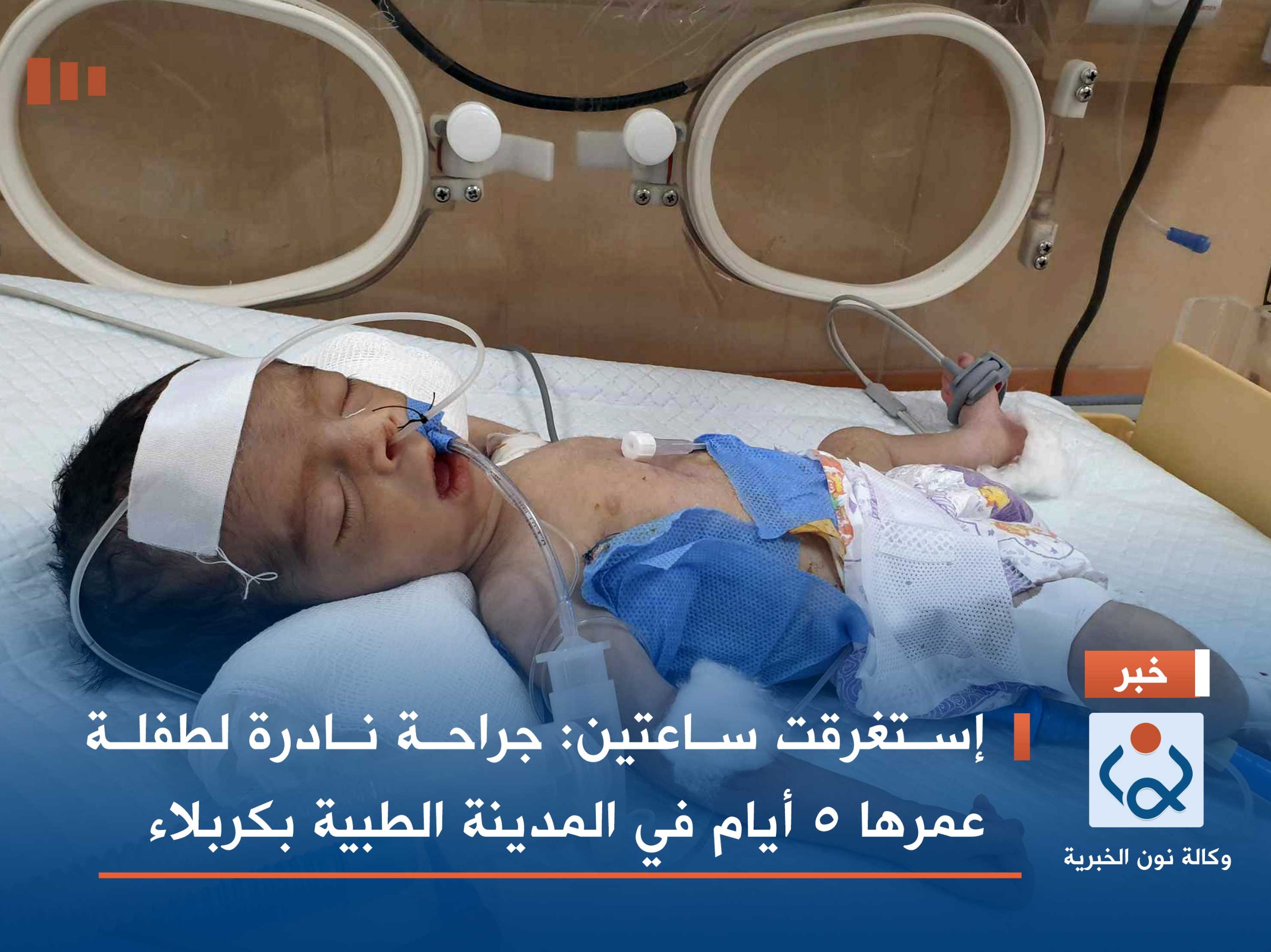 إستغرقت ساعتين : جراحة نادرة لطفلة عمرها 5 أيام في المدينة الطبية بكربلاء